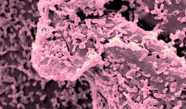 When The Germs Come Marching In. On Biofilms & Bacteria