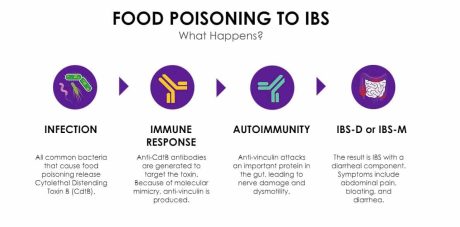Food-poisoning-to-IBS