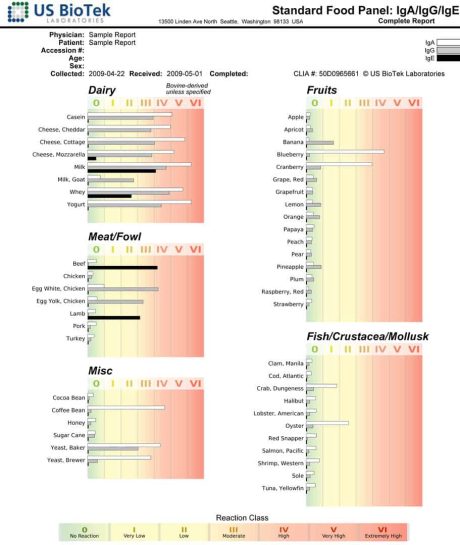 IgG-Ige-IgA-test-results